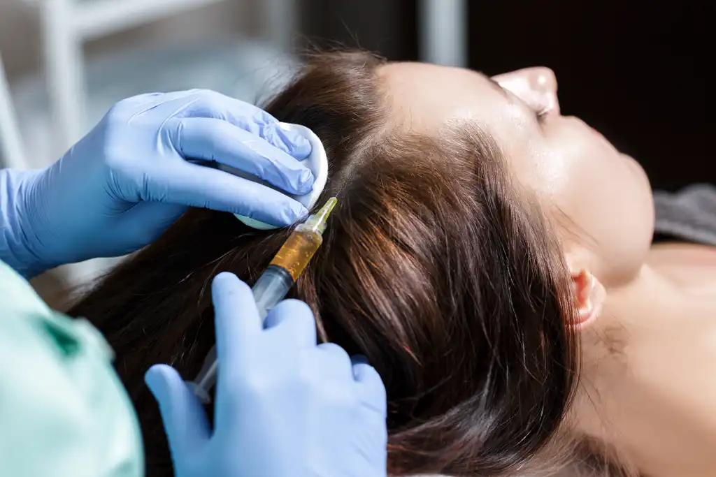 Mesotherapie für Haarwachstum Mesotherapie für Haarwachstum
